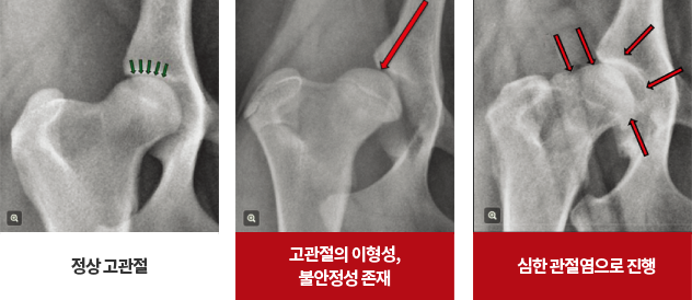 강아지 고관절 이형성증 수술 비용