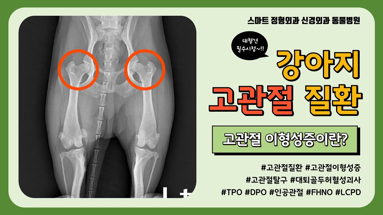 방사선 등급이 나오면 견적이 어떻게 갈릴까